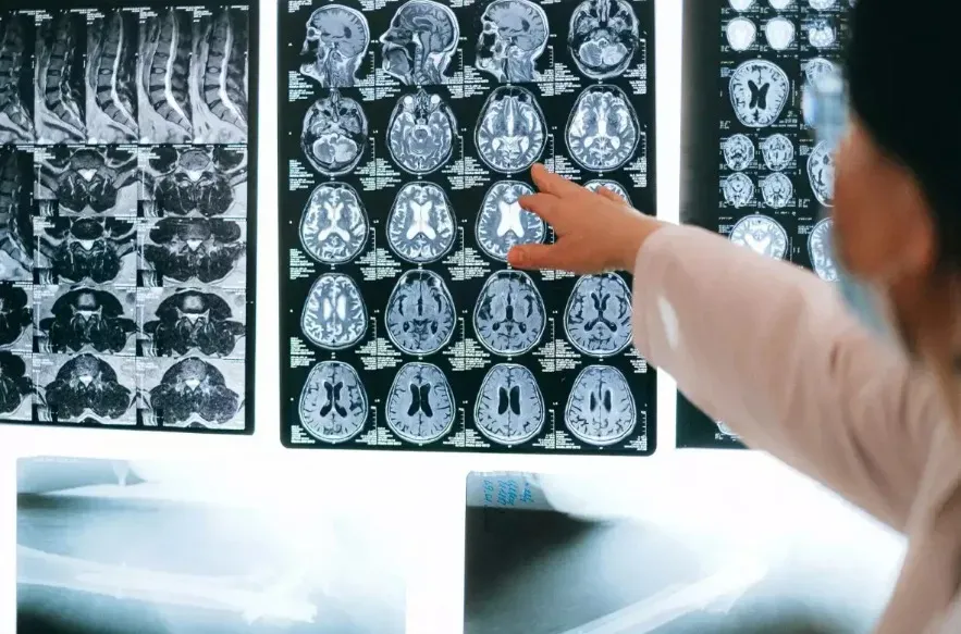 Estudo revela crescimento de doença cardíaca e AVC na população; entenda