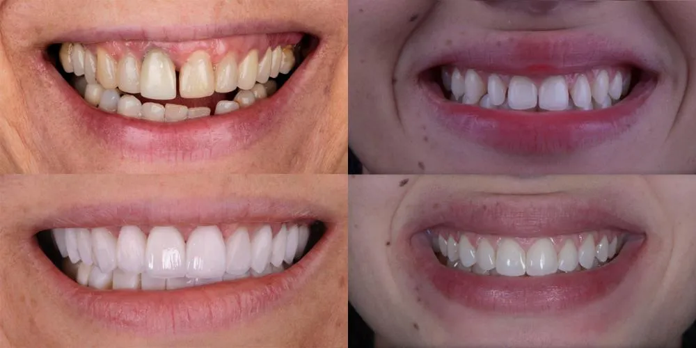 Brasil ocupa segundo lugar em transformações estéticas odontológicas no mundo