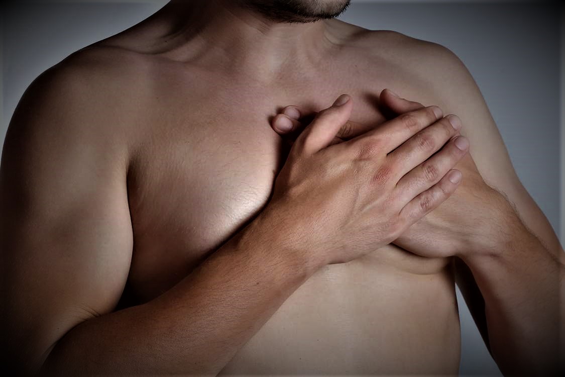 Entenda a ginecomastia masculina, aumento mamário em homens é mais comum e complexo do que se imagina