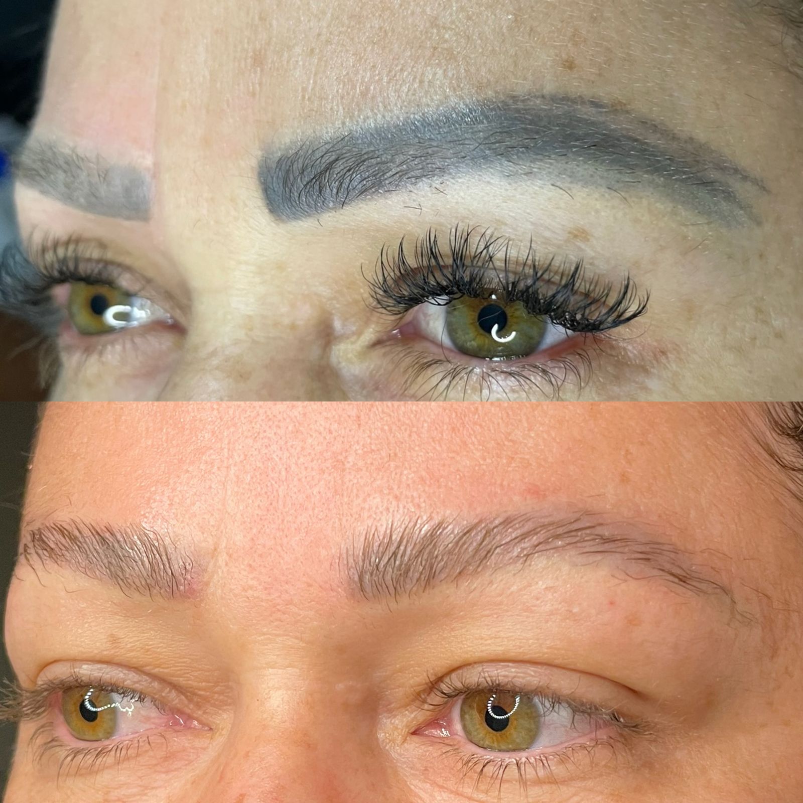 Despigmentação a laser impulsiona nova fase da estética e muda o padrão das sobrancelhas no Brasil