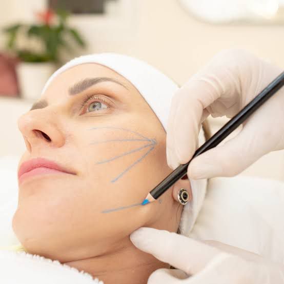 Sculptra alia naturalidade e sofisticação no rejuvenescimento facial ao estimular a produção de colágeno